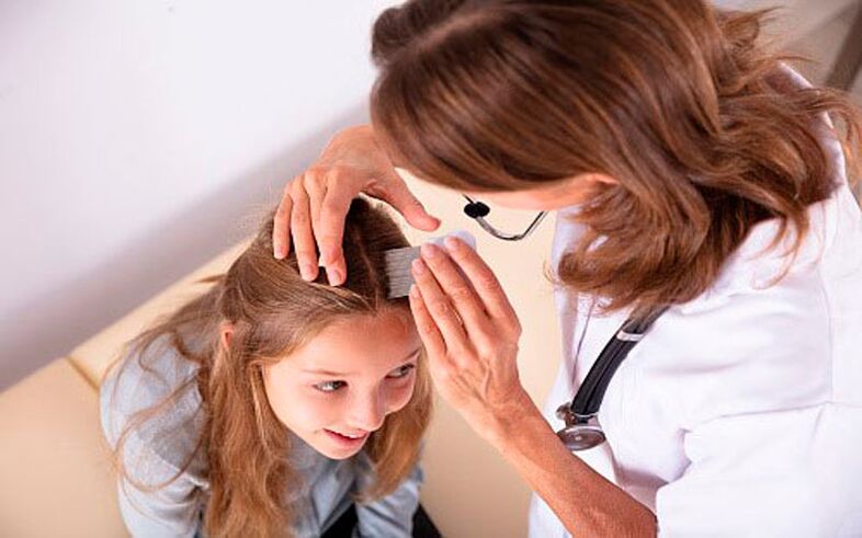 tratamentul psoriazisului capului la copii