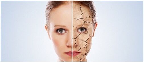 Tratează psoriazisul